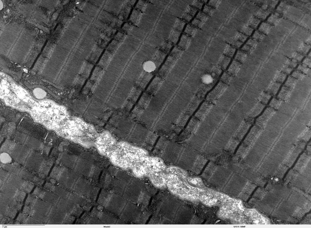 Muscolo scheletrico umano al microscopio elettronico con le bande dei sarcomeri